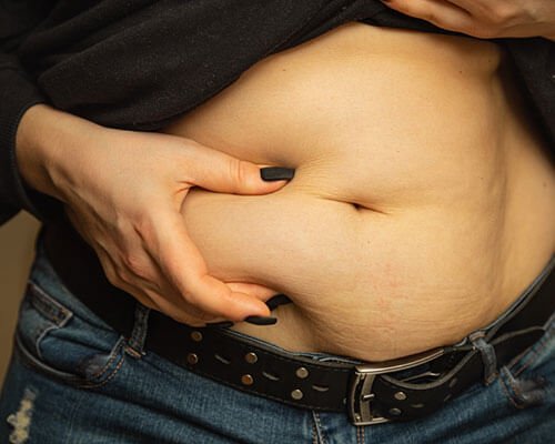 Endoscopic Obesity Therapy