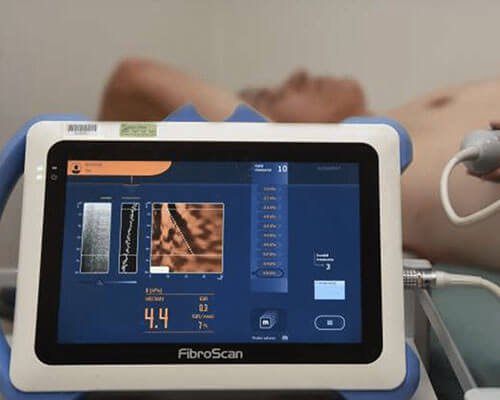 Fibroscan